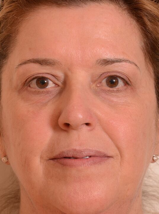 Noorendasin nägu Eudalie kreemiga