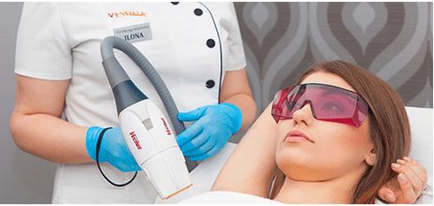 Laser noorendamine